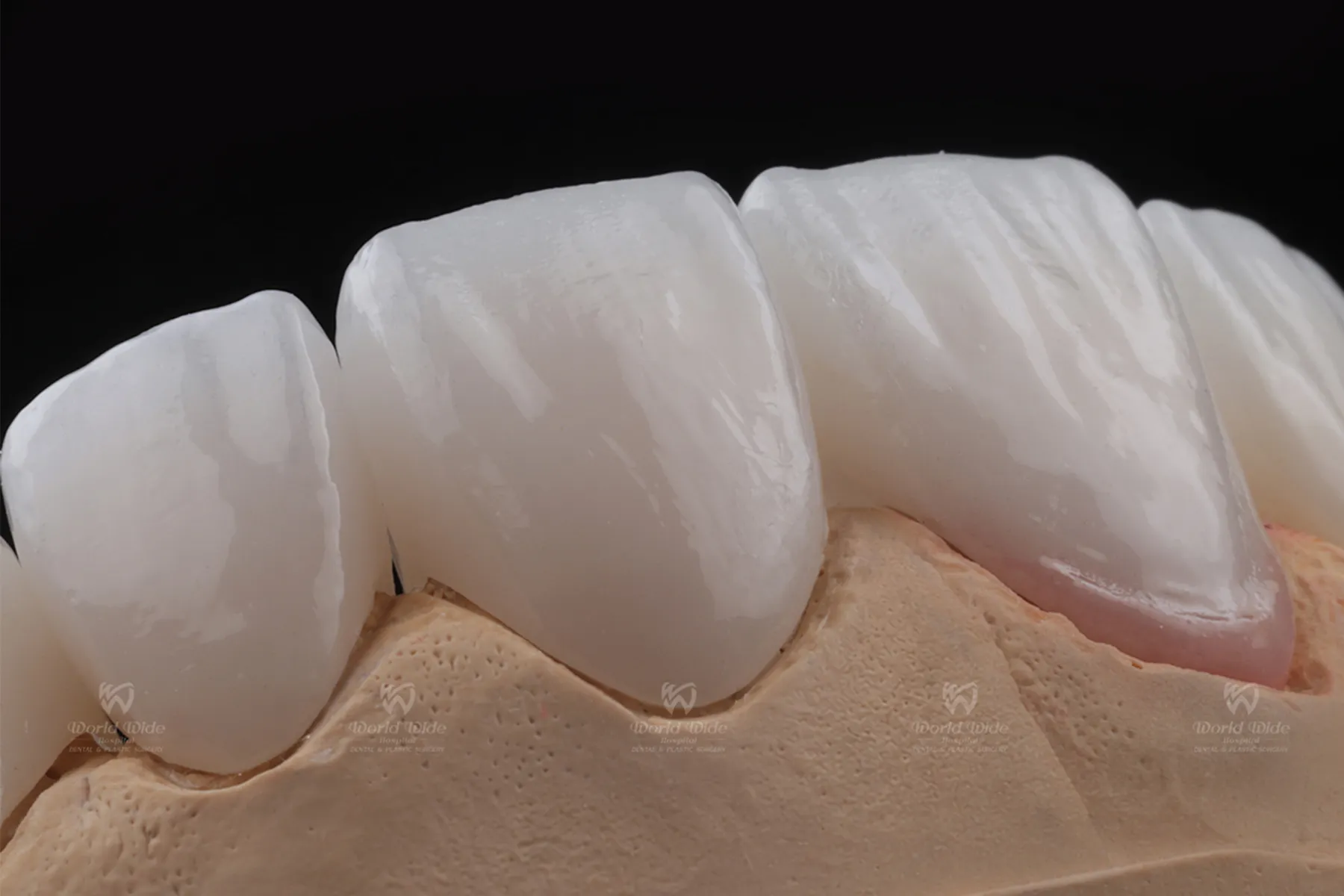 Khả năng chống nhiễm màu tốt