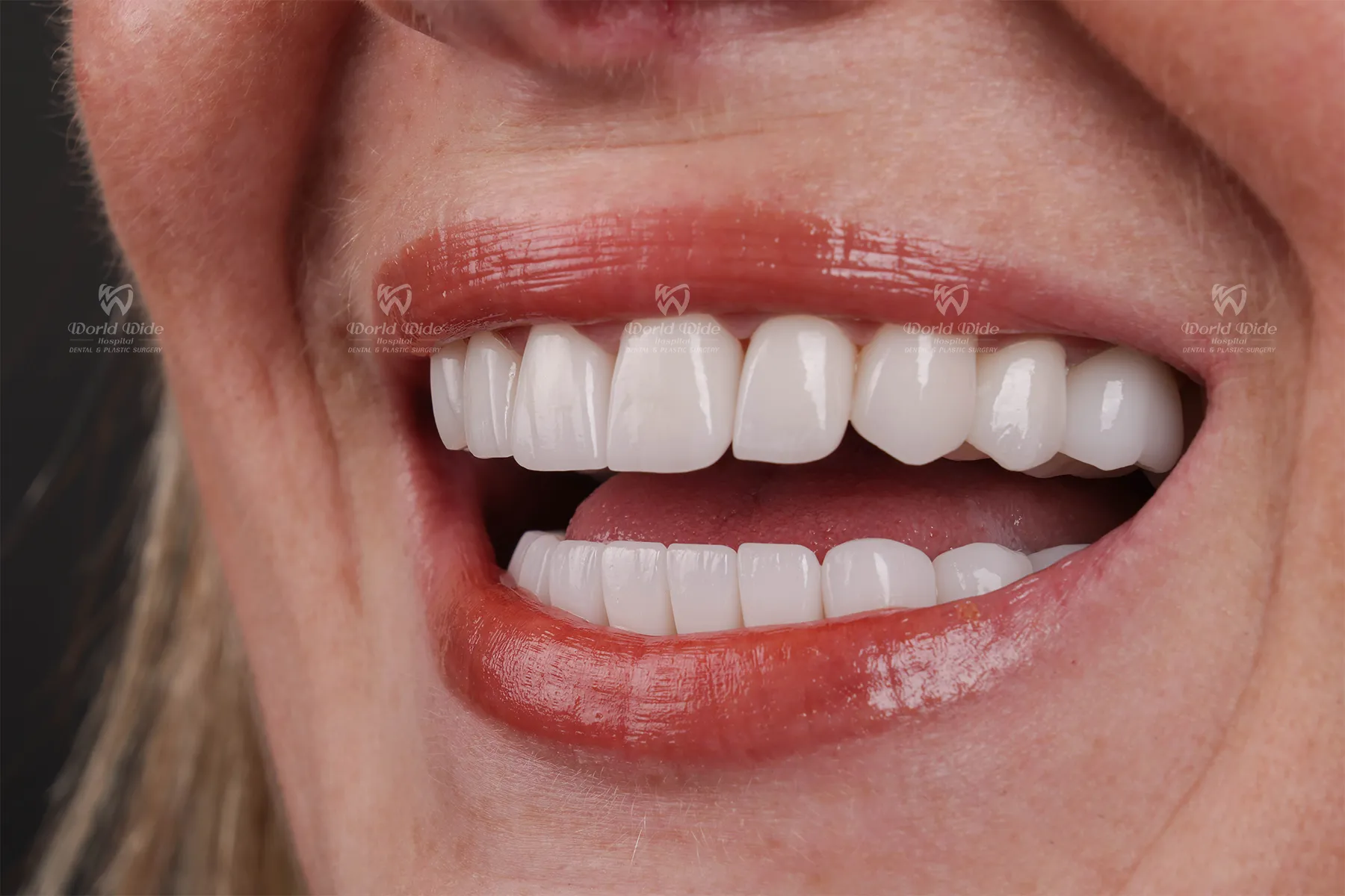 Cân bằng giữ thẩm mỹ và chức năng